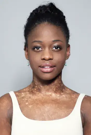 Fotografia de Michaela DePrince
