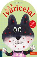 1, 2, 3... ¡Varicela!