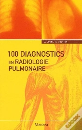 100 Diagnostics En Radiologie Pulmonaire