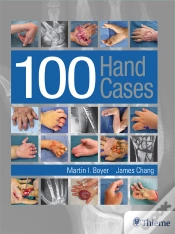 Capa do artigo 100 Hand Cases