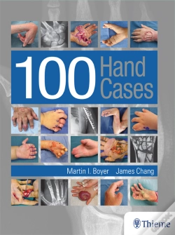 Capa do artigo 100 Hand Cases