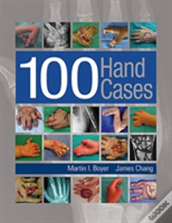 Capa do artigo 100 Hand Cases