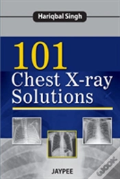 Capa do artigo 101 Chest X-Ray Solutions