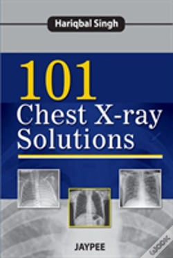 Capa do artigo 101 Chest X-Ray Solutions