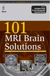 Capa do artigo 101 Mri Brain Solutions
