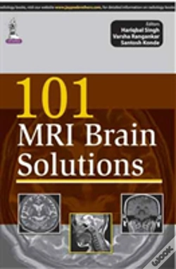 Capa do artigo 101 Mri Brain Solutions