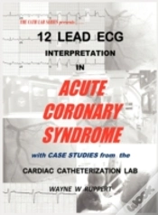 Capa do artigo 12 Lead Ecg Interpretation In Acute Coronary Syndrome With Case Studies From The Cardiac Catheterization Lab