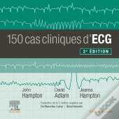 150 Cas Cliniques D'Ecg (2e Édition)