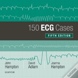 Capa do artigo 150 Ecg Cases