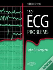 Capa do artigo 150 Ecg Problems