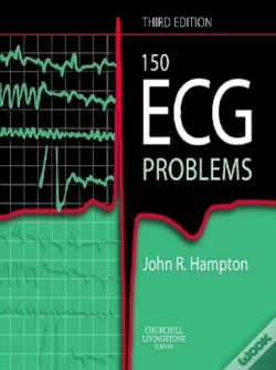 Capa do artigo 150 Ecg Problems