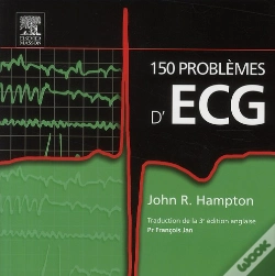 Capa do artigo 150 Problemes D'Ecg