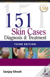 Capa do artigo 151 Skin Cases