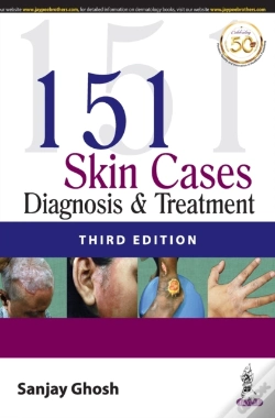 Capa do artigo 151 Skin Cases