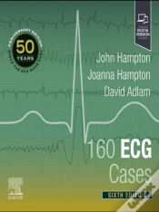 Capa do artigo 160 Ecg Cases