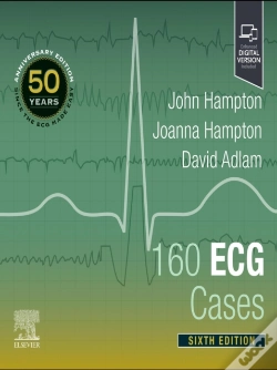Capa do artigo 160 Ecg Cases