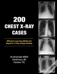 200 Chest X-Ray Cases