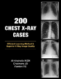 200 Chest X-Ray Cases - Preview