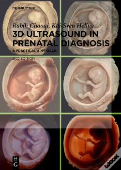 Capa do artigo 3d Ultrasound In Prenatal Diagnosis