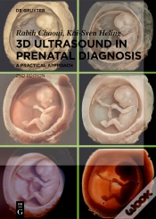 Capa do artigo 3d Ultrasound In Prenatal Diagnosis