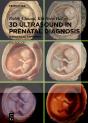 3d Ultrasound In Prenatal Diagnosis - Preview
