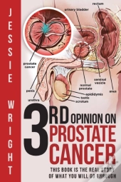 3rd Opinion On Prostate Cancer