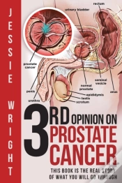 Capa do artigo 3rd Opinion On Prostate Cancer