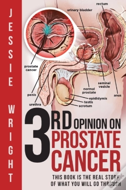 Capa do artigo 3rd Opinion On Prostate Cancer