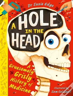 Capa do artigo A Hole In The Head