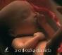 A Odisseia da Vida - Preview