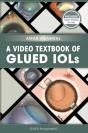 A Video Textbook Of Glued Iols - Preview