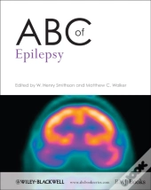 Abc Of Epilepsy
