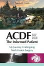 Acdf - Preview