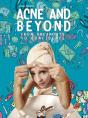 Acne And Beyond - Preview