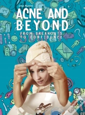 Capa do artigo Acne And Beyond