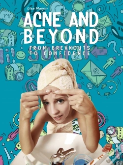 Capa do artigo Acne And Beyond