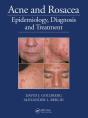 Acne And Rosacea - Preview