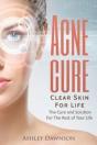 Acne Cure Clear Skin For Life - Preview