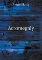 Acromegaly - Preview