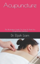 Acupuncture