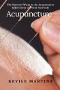Acupuncture - Preview