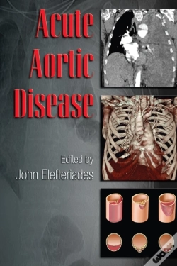 Capa do artigo Acute Aortic Disease