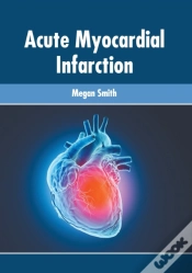 Capa do artigo Acute Myocardial Infarction
