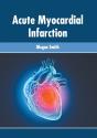 Acute Myocardial Infarction - Preview