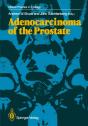 Adenocarcinoma Of The Prostate - Preview