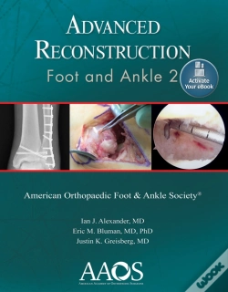 Capa do artigo Advanced Reconstruction: Foot And Ankle 2: Print + Ebook