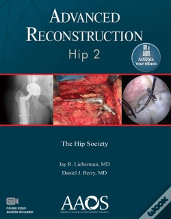 Capa do artigo Advanced Reconstruction: Hip 2: Print + Ebook With Multimedia