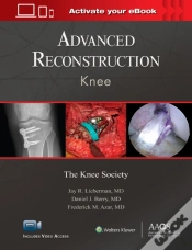 Capa do artigo Advanced Reconstruction: Knee: Print + Ebook With Multimedia