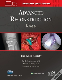 Capa do artigo Advanced Reconstruction: Knee: Print + Ebook With Multimedia