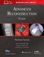 Advanced Reconstruction: Knee: Print + Ebook With Multimedia - Preview